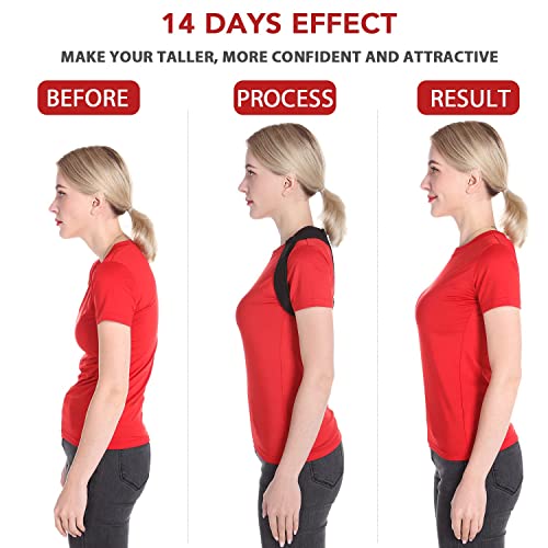 51qojadox6l.jpg Best Posture Corrector for Men and Women - Comfortable Upper and Back Support, Adjustable Back Straightener | Postur