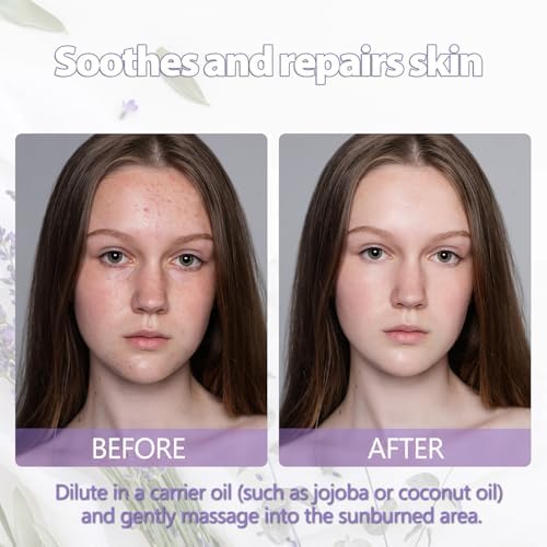 PHATOIL Australian Sandalwood Essential Oil |38Fl Oz for Hair Care and Body Skin Care | PHATOIL Australian Sandalwood E